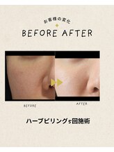 レモンスタジオ 秩父店/お客様施術例