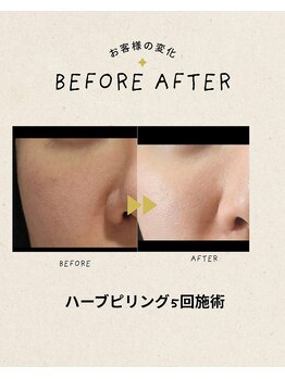 レモンスタジオ 秩父店/お客様施術例
