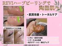 ルアナ(Luana)の雰囲気（Instagram、Youtubeでも話題☆REVIハーブピーリング☆肌質改善！）