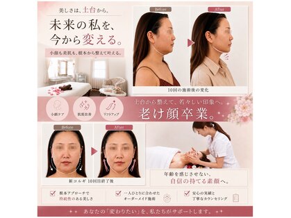 フローラの写真