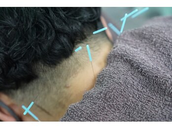 グリーン整骨院/頭痛や肩こりでお悩みの方へ