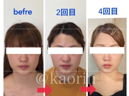 カオリン(顔凛)の写真