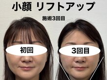 ステキナ/お客様の施術症例