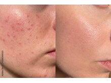 リアンシャンテ(Re enchanter)/