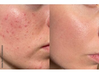 リアンシャンテ(Re enchanter)/