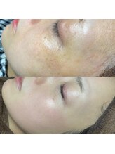 ホワラ 横浜店(Whila)/施術効果6