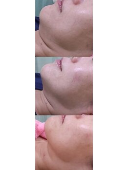 ザエステショップ/