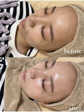 ミーミドットアイ(Mi-mi.i)/お肌は土台作りから！