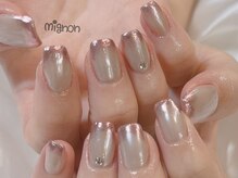 ミニョン(mignon)/mignon定額コース