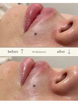 オフオルファヴォリ(OF Olu:Favori)/【フラッシュワックス脱毛】