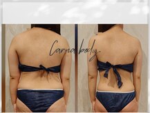 カルナボディ(Carna body.)