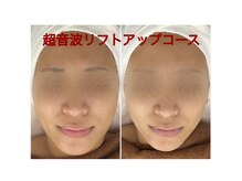 ちゅるん肌ドットコム 心斎橋店(ちゅるん肌.com)