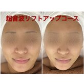 ちゅるん肌ドットコム 心斎橋店(ちゅるん肌.com)