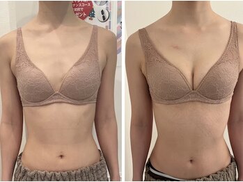 美人バスト 千早店/バストアップ◇育乳症例◇