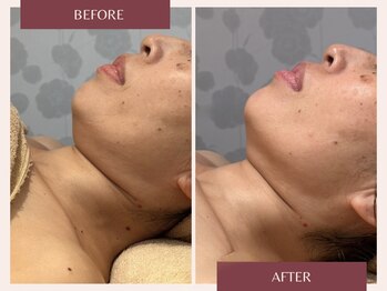 トリプルサンショップ 京都店/【極上フェイシャルプレミアム】