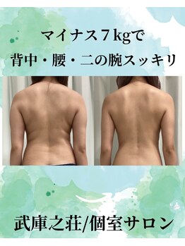 エデン(Eden)/背中/腰/二の腕 後ろ姿スッキリ