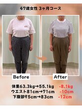 くさば整骨院/47歳女性/ダイエット3か月コース