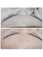 ステイ(STAY)/シェービング後は透明感がUP！