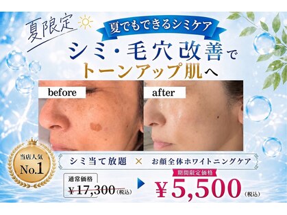 パールホワイトニングサロン 大船店の写真