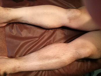 エン(en.)/BeforeAfter写真24