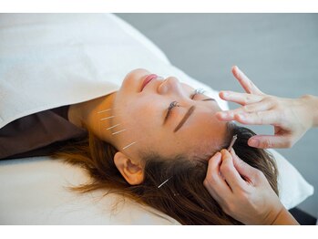 デルタエヌピー63+(δnp63+)/小顔美容鍼【小顔/薬院/福岡】