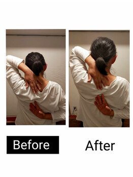 アース エンジェル整体院/ビフォアフ 肩甲骨はがし