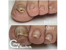 エンヴィ(ENVY)の雰囲気（痛い巻爪ご相談下さい◎巻爪ケアインストラクターによる巻爪ケア）