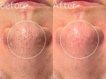 マイナプラ 表参道(myna+)/