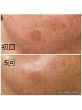 ビューティーサロン キャンディ 海老名(Candy)/