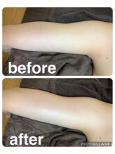 ギンザアール(GINZA R.)/二の腕に集中アプローチ！