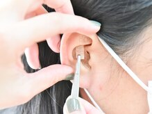 スナオダイエット けやき台(SunaoDiet)/[4] 耳つぼ施術