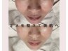 【キメを整える】陶肌トリートメント ￥19,800