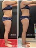 【本気で-5kg・-10kg減！】３万人以上を痩身成功！Lien式激痩せコース