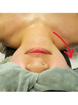 レポリア(Reporia)/EMSヘッドブラシBeforeAfter