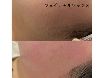 ベル(BELLE)/フェイシャルワックス脱毛★