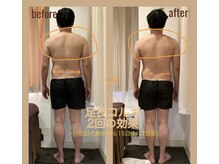 レアフィート(Rheafeet)/症例写真です。