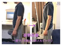テールボーテ(Terre beaute)/猫背が気になります