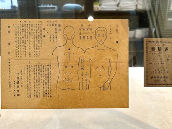 アノン 松山(Anon)/伝説のはり師