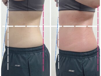 キラビ マリン呉キレイ館(KIRA★美)/1回のお試しでの効果です☆