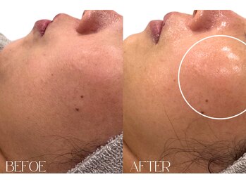 マグノリア(Magnolia)/小顔EMS×ソニック*たるみ改善