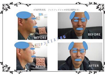 磨凛/光フェイシャル