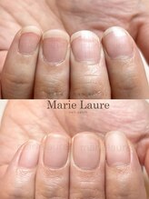 マリーロール 淀屋橋本店(Marie Laure)/深爪矯正/自爪育成/ネイルケア