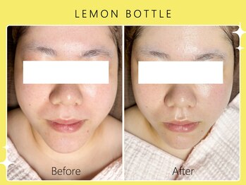 シロカネ イオンタウン西熊本店(SHIROKANE)/レモンボトル☆