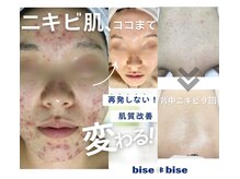 ビズビズ 天王寺店(bisebise)