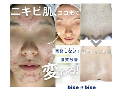 ビズビズ 天王寺店(bisebise)の写真