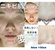 ビズビズ 天王寺店(bisebise)