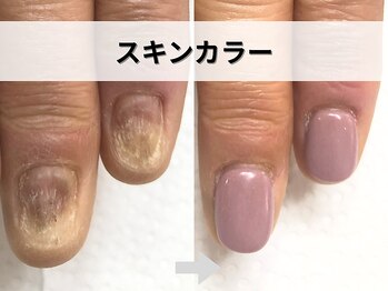 ブルームーンネイルズ(BLOOMOON.nails)/スキンカラー