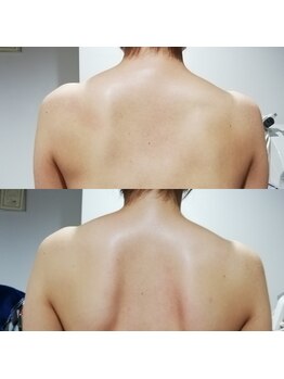 RiとBiのたまご/上半身のこり緩和マッサージ１回