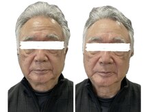 フリジア(Phrygien)/ドライヘッドスパ