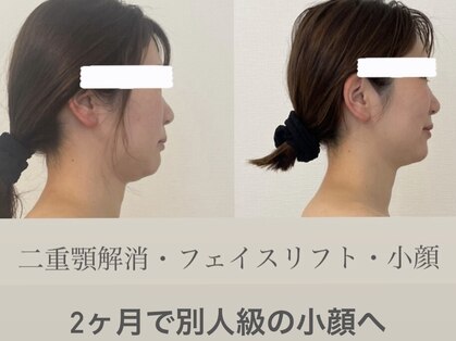 めい鍼灸院の写真